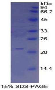 Human IL25 / IL17E Protein (Recombinant His)