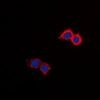 Polyclonal Rabbit anti-Human SLC9A8 / NHE8 Antibody (C-Terminus, IHC, IF, WB)