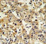 CA6 / Carbonic Anhydrase 6 Antibody (aa279-308)