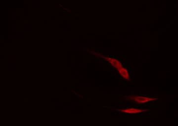 PLCG2 / PLC Gamma 2 Antibody (phospho-Tyr753)