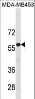 UGT2B4 Antibody (aa68-96)