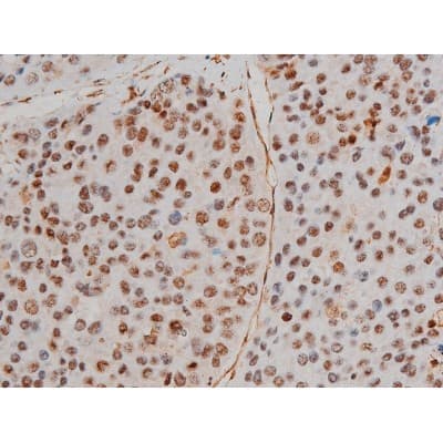Polyclonal Rabbit anti-Human FLNA / Filamin A Antibody (phospho-Ser2152, IHC, IF, WB)