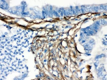 CALD1 / Caldesmon Antibody