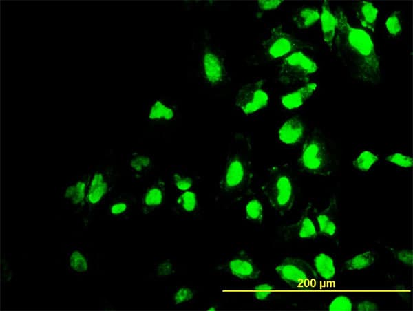 Monoclonal Mouse anti-Human POLR1C / RPA39 Antibody (clone 3A5-H2, IHC, IF, WB)