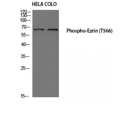 EZR / Ezrin Antibody (510-590 aa)