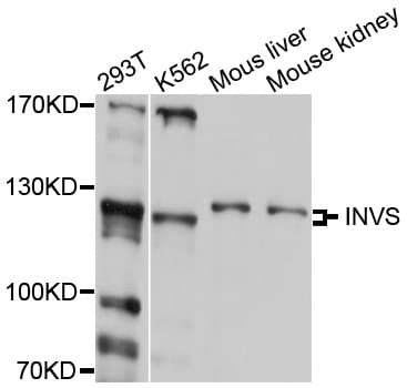 INVS / Inversin Antibody