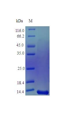 Human MDK / Midkine Protein (Recombinant)