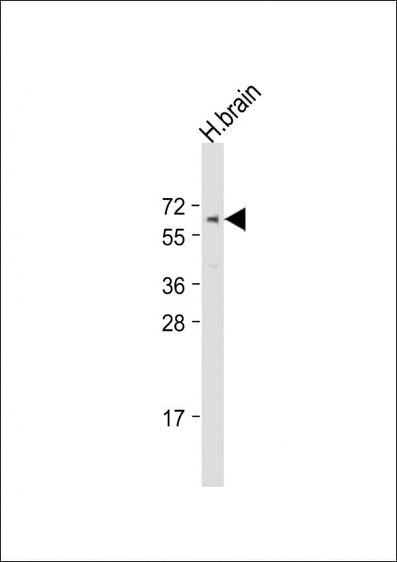 ZKSCAN3 / ZNF306 Antibody (aa100-130)
