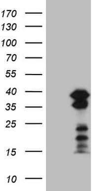 Monoclonal Mouse anti-Human POU2AF1 / BOB1 Antibody (clone OTI2D4, IHC, WB)