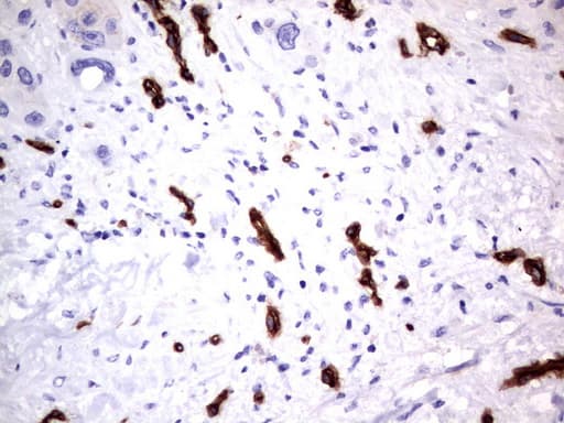 MCAM / CD146 Antibody (clone UMAB154)
