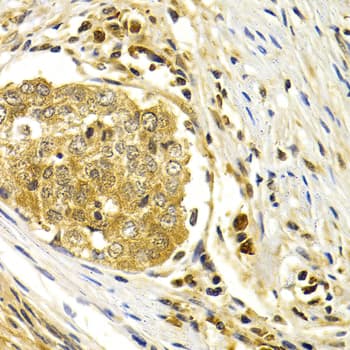CDK7 Antibody