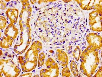 Polyclonal Rabbit anti-Human CYP27 / CYP27A1 Antibody (IHC)