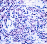 Polyclonal Rabbit anti-Human AP-1 / JUND Antibody (IHC, WB)