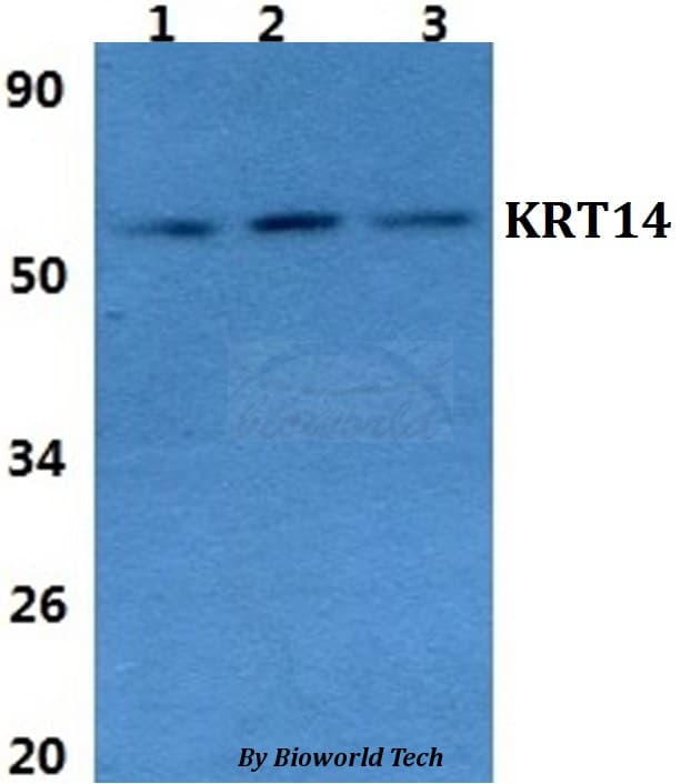 Polyclonal Rabbit anti-Human KRT14 / CK14 / Cytokeratin 14 Antibody (IHC, WB)