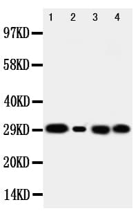 Polyclonal Rabbit anti-Human CA1 / Carbonic Anhydrase I Antibody (aa51-68, WB)