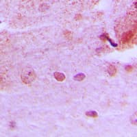 HPMS1 / PMS1 Antibody (Internal)
