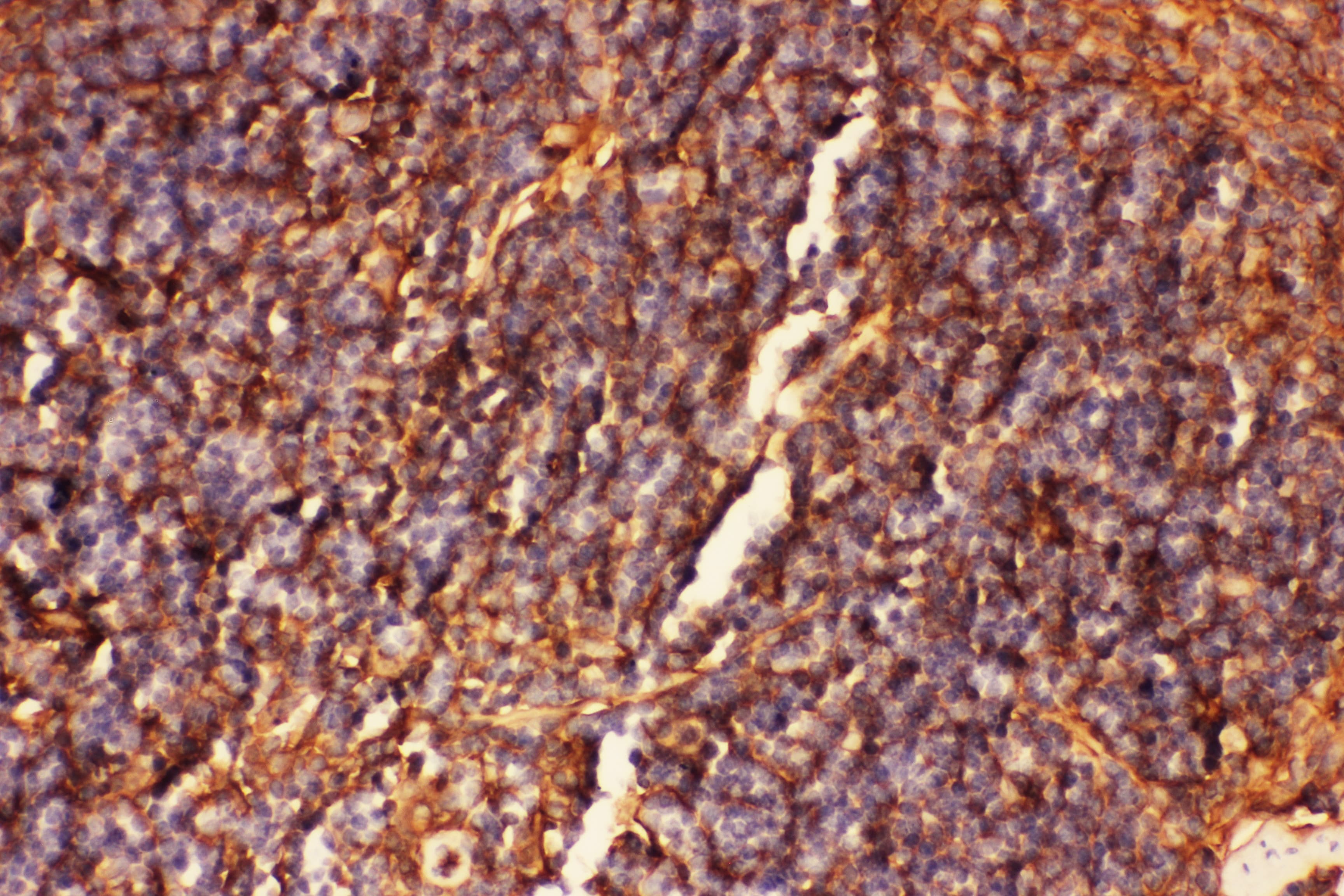 ICAM-1 / CD54 Antibody (aa198-537)