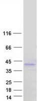 Human NCR1 / NKP46 Protein (Recombinant Myc-DDK (Flag))