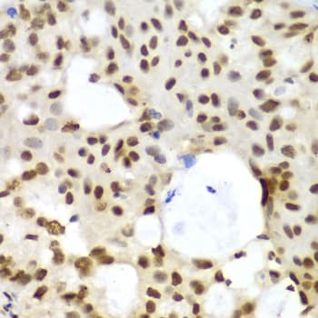 IHC-plus™ LIG3 / DNA Ligase III Antibody