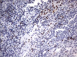 p16INK4a / CDKN2A Antibody (aa25-156, clone OTI1F6)
