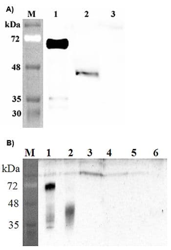 DLK1 / Pref-1 Antibody (Extracellular Domain)