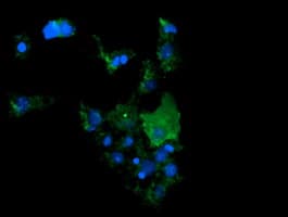 Monoclonal Mouse anti-Human CTAG1B / NY-ESO-1 Antibody (clone OTI1G9, IF, WB)