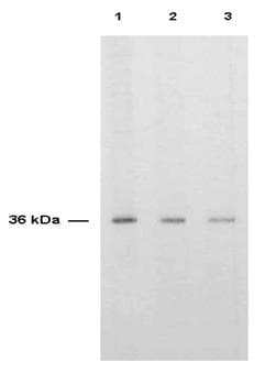 TS / Thymidylate Synthase Antibody