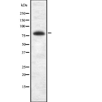 BRSK2 Antibody