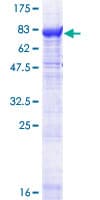 Human PDE1A Protein (Recombinant GST)