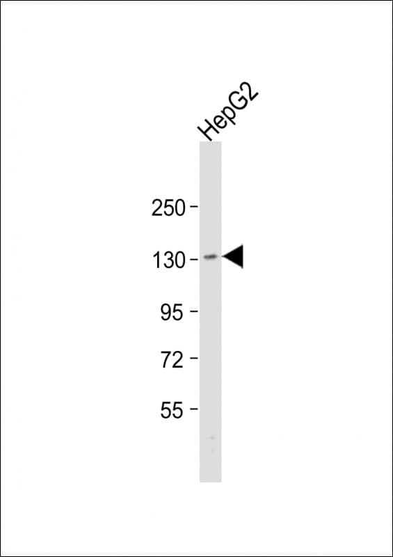 Polyclonal Rabbit anti-Human TMF1 / TMF-1 Antibody (aa447-480, WB)