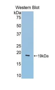 LCAT Antibody (aa290-432)