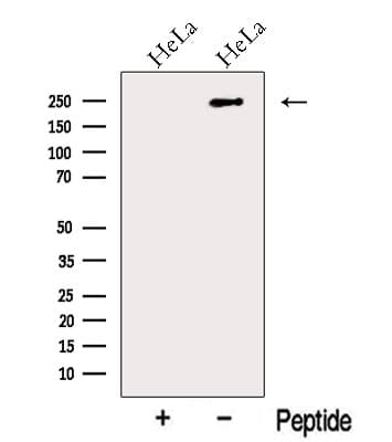 Polyclonal Rabbit anti-Human MYH10 Antibody (WB)
