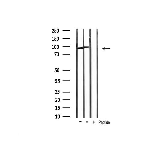 Polyclonal Rabbit anti-Human CTNNB1 / Beta Catenin Antibody (IHC, IF, WB)