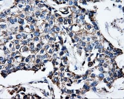 ATP5B / ATP Synthase Beta Antibody (clone OTI1B10)
