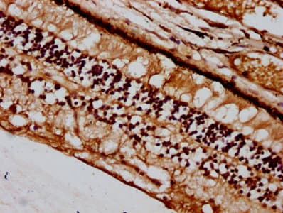 Polyclonal Rabbit anti-Human BFSP2 Antibody (IHC, IF, WB)