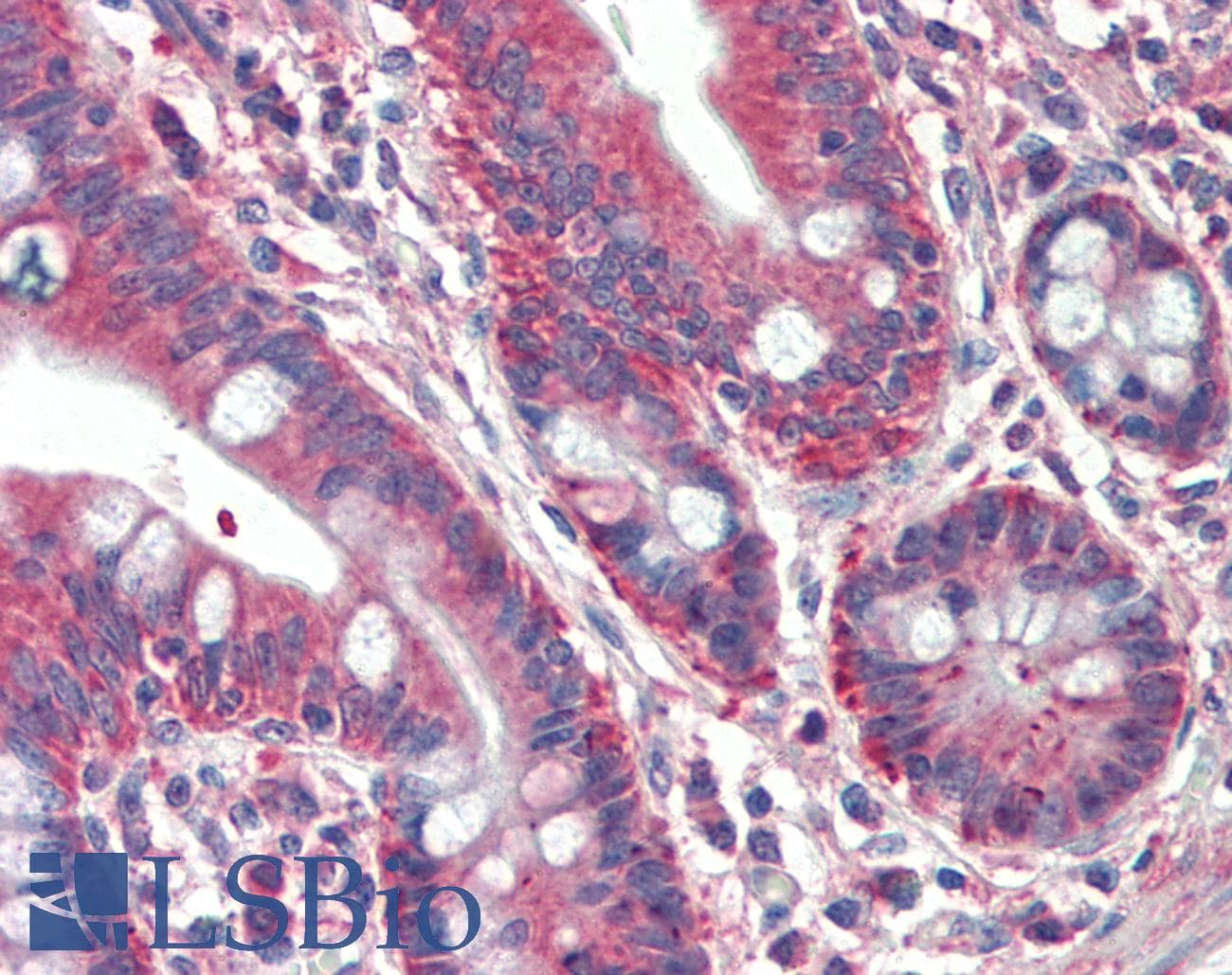 IHC-plus™ RUFY1 Antibody (aa479-491)