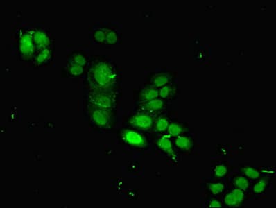 HIST1H2BB Antibody (aa2-126)