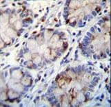 Polyclonal Rabbit anti-Human C1QG / Complement C1QC Antibody (aa93-120, IHC, IF, WB)