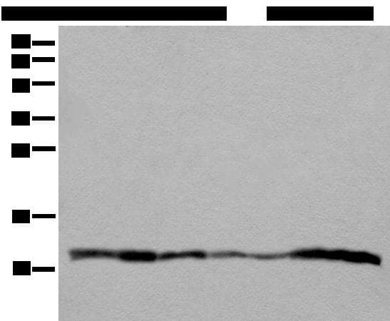 UQCRQ Antibody