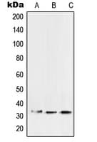 SFTPA2 / Surfactant Protein A2 Antibody (Internal)