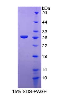 Human RELN / Reelin Protein (Recombinant His-T7)
