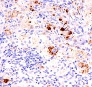 TNF Alpha Antibody (aa115-130, clone TNF706 + P/T2)