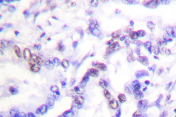 CCNE1 / Cyclin E1 Antibody (Ile119)