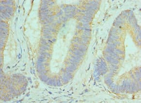 GOLM1 / GP73 / GOLPH2 Antibody (aa112-401)