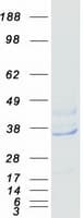 Human EIF3I / EIF3S2 Protein (Recombinant Myc-DDK (Flag))