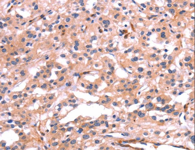 Polyclonal Rabbit anti-Human FAP-1 / PTPN13 Antibody (IHC)