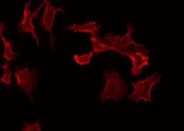 TUBGCP4 Antibody