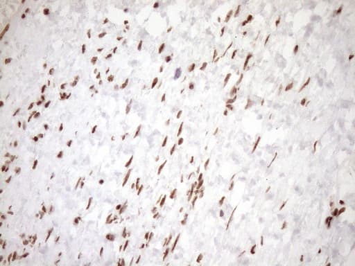 EXOSC1 / CSL4 Antibody (clone OTI1H9)
