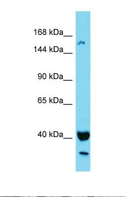 Polyclonal Rabbit anti-Human KIAA1683 Antibody (aa43-92, WB)