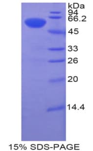 Human BTK Protein (Recombinant His-GST)